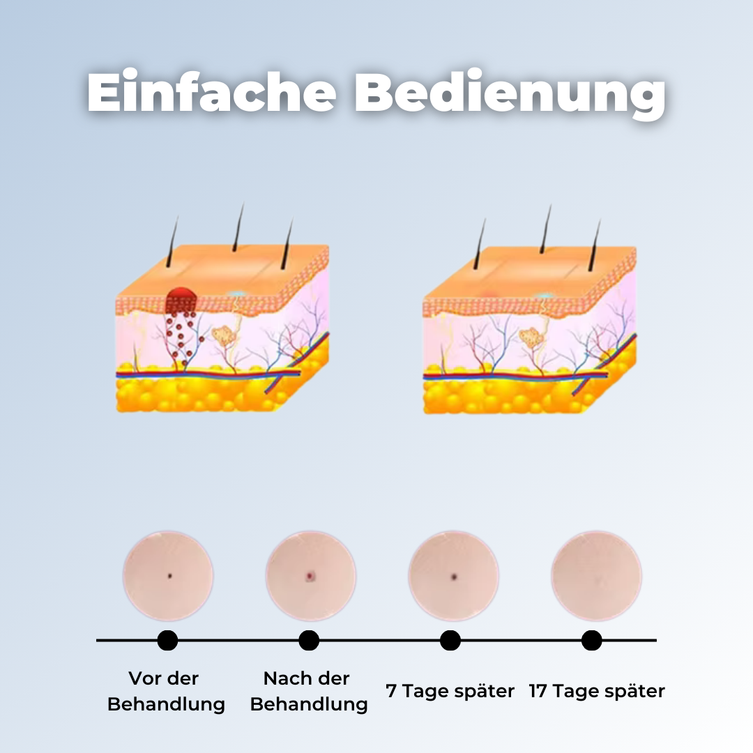 RadiPen - Hautpflege-Stift