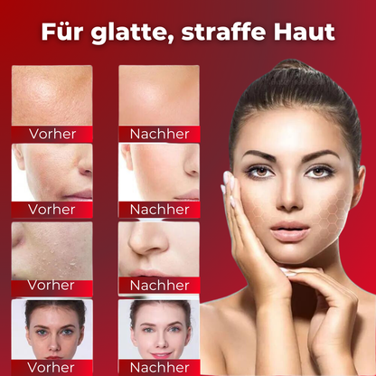 SkinLift - das Original