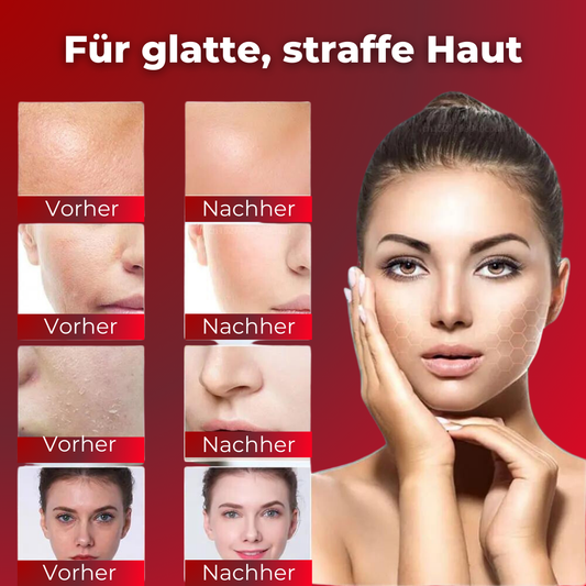 SkinLift - das Original