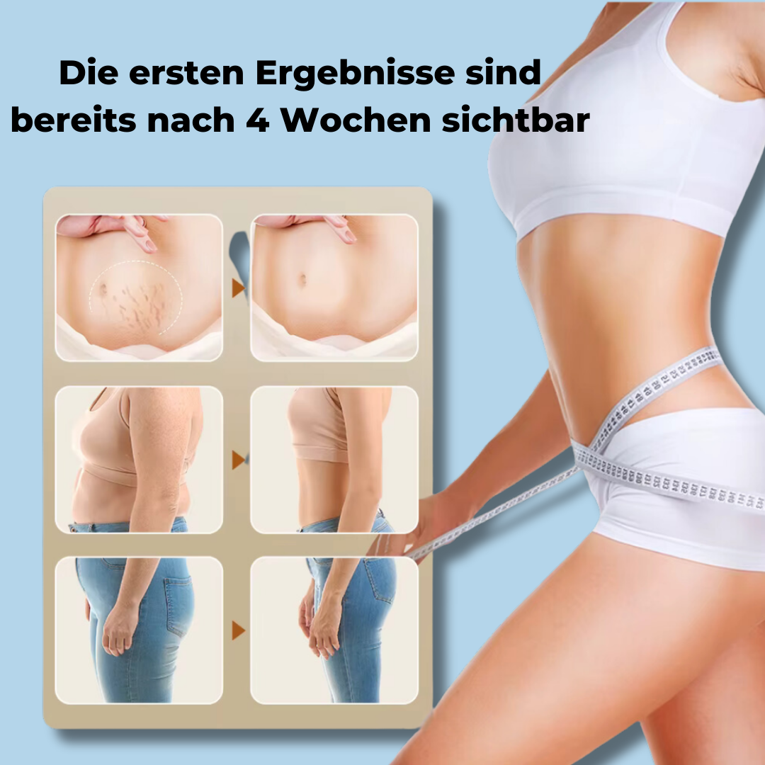 Slimex - Fettabbau- und Hautstraffungsgerät