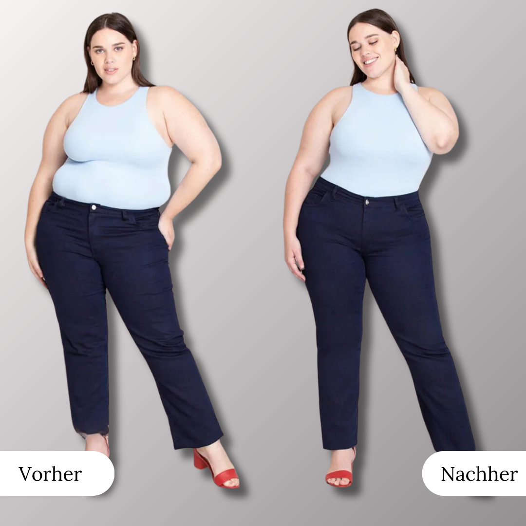 VelaShape - Bodyshaper